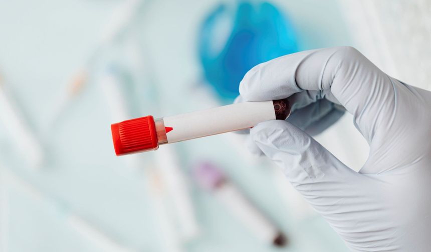 Alzheimer yıllar önceden kan testiyle anlaşılır mı?